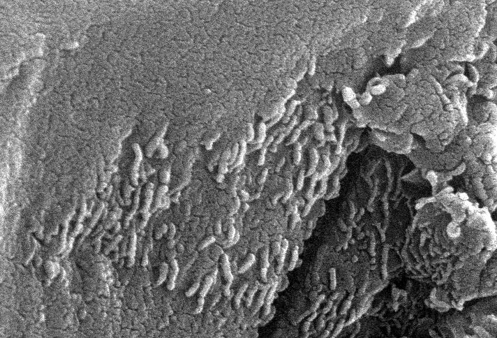 APOD: 1996 August 07 – Early Microscopic Life on Mars?
