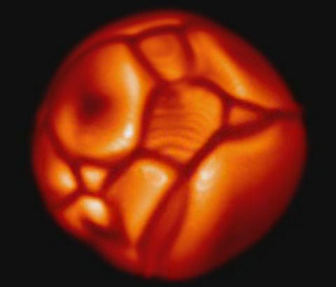 APOD: 2000 December 22 – Simulated Supergiant Star