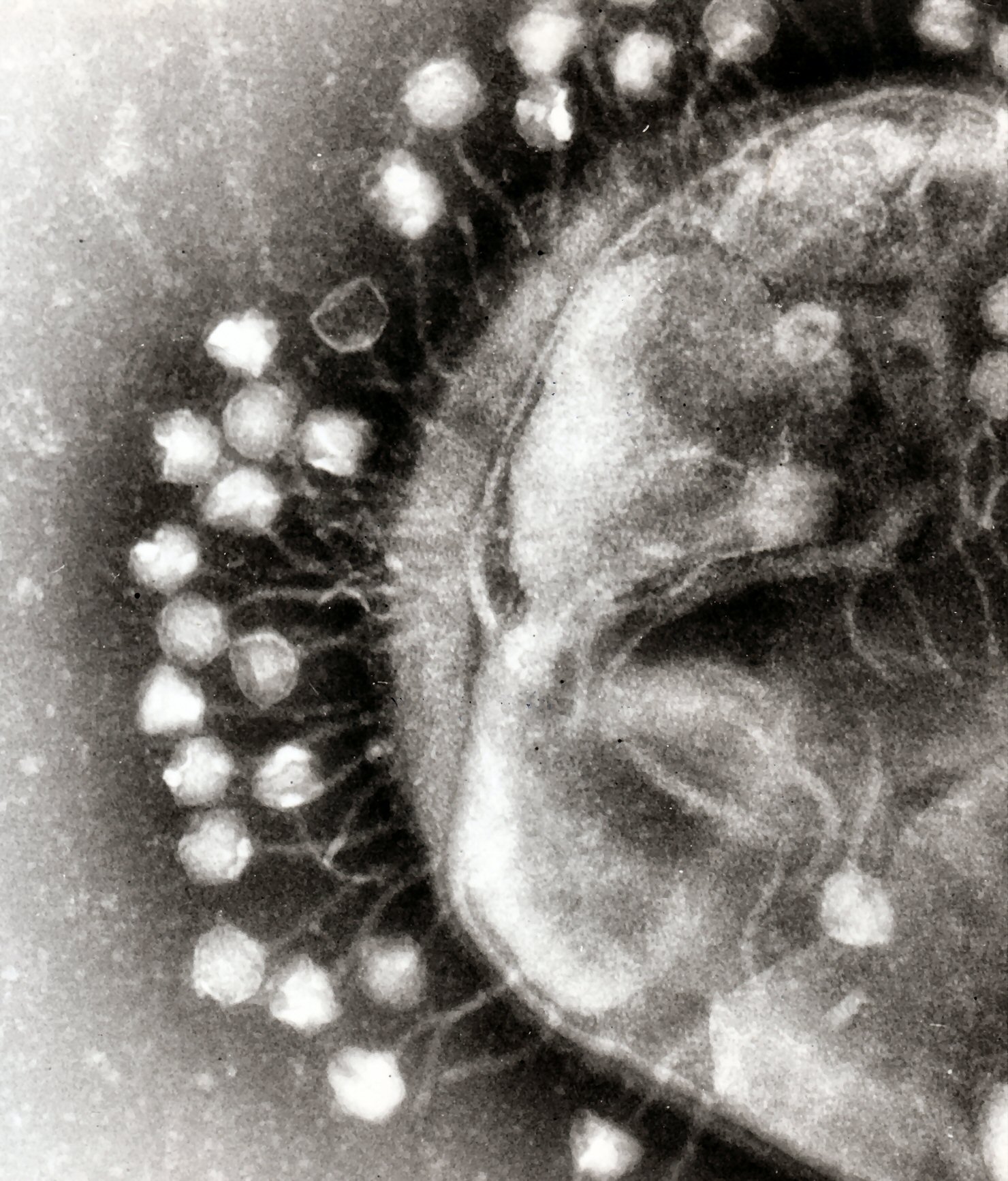 APOD: 2008 April 21 – Bacteriophages: The Most Common Life Like Form on Earth