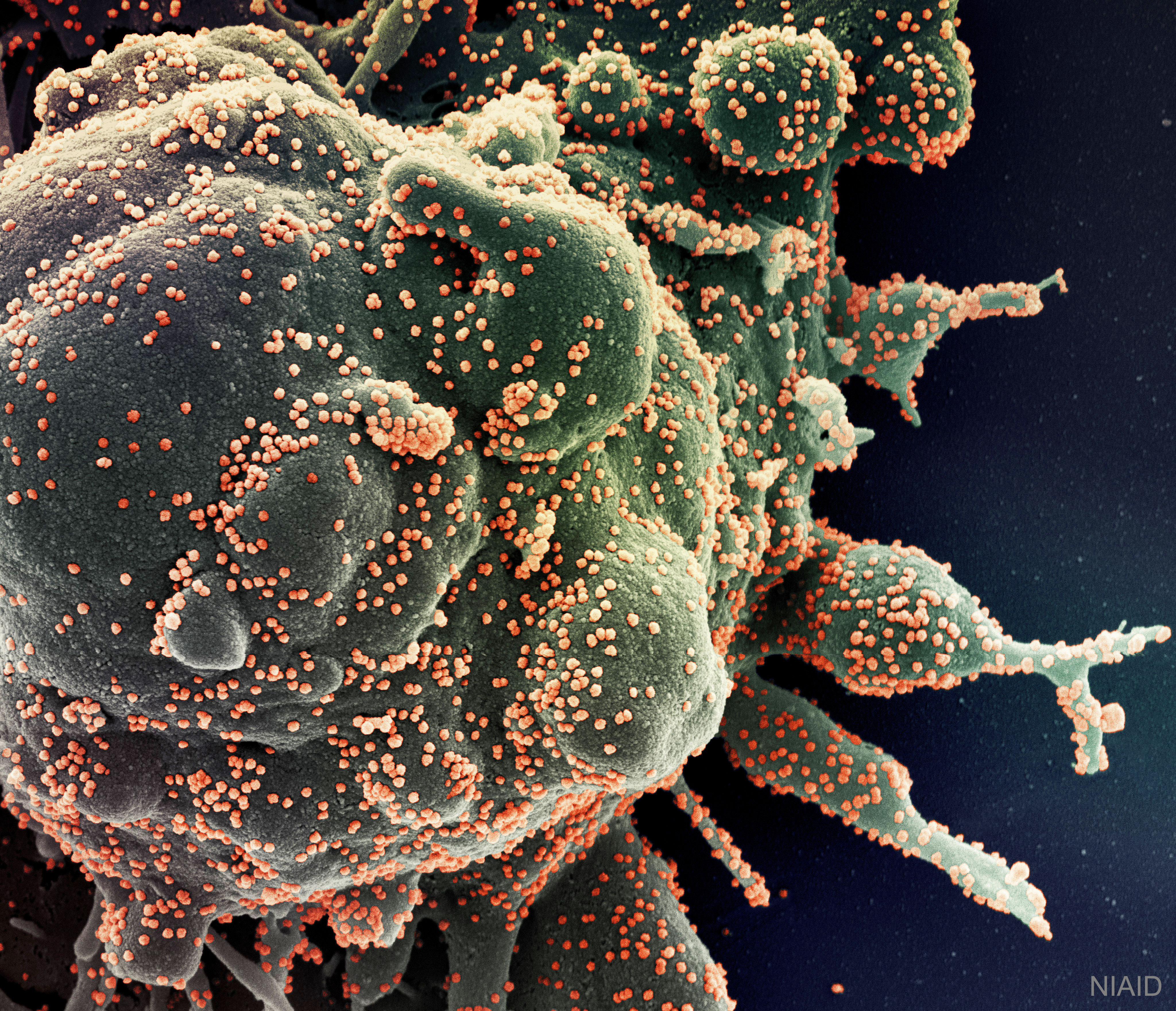 APOD: 2020 June 2 – Novel Coronavirus Attacks Humanity