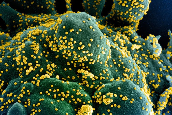 A scanning electron micrograph shows viral particles (yellow) on a dying cell (green).