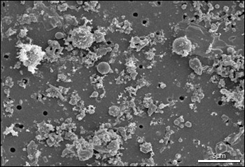 Micrograph of 2.5 micro meter particles