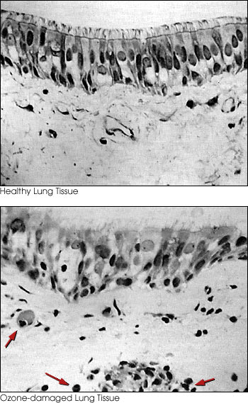 Micrographs of Human Lung Tissue