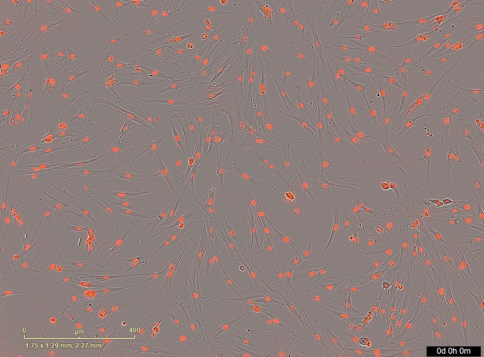 Microscopic image of red-stained mesenchymal stem cells scattered across a gray background.