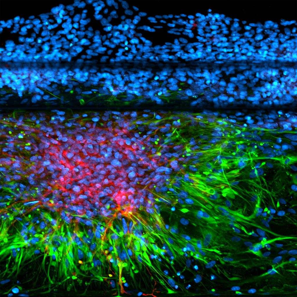 Computer monitor displaying a vibrant scientific visualization with blue, red, and green cell-like patterns.