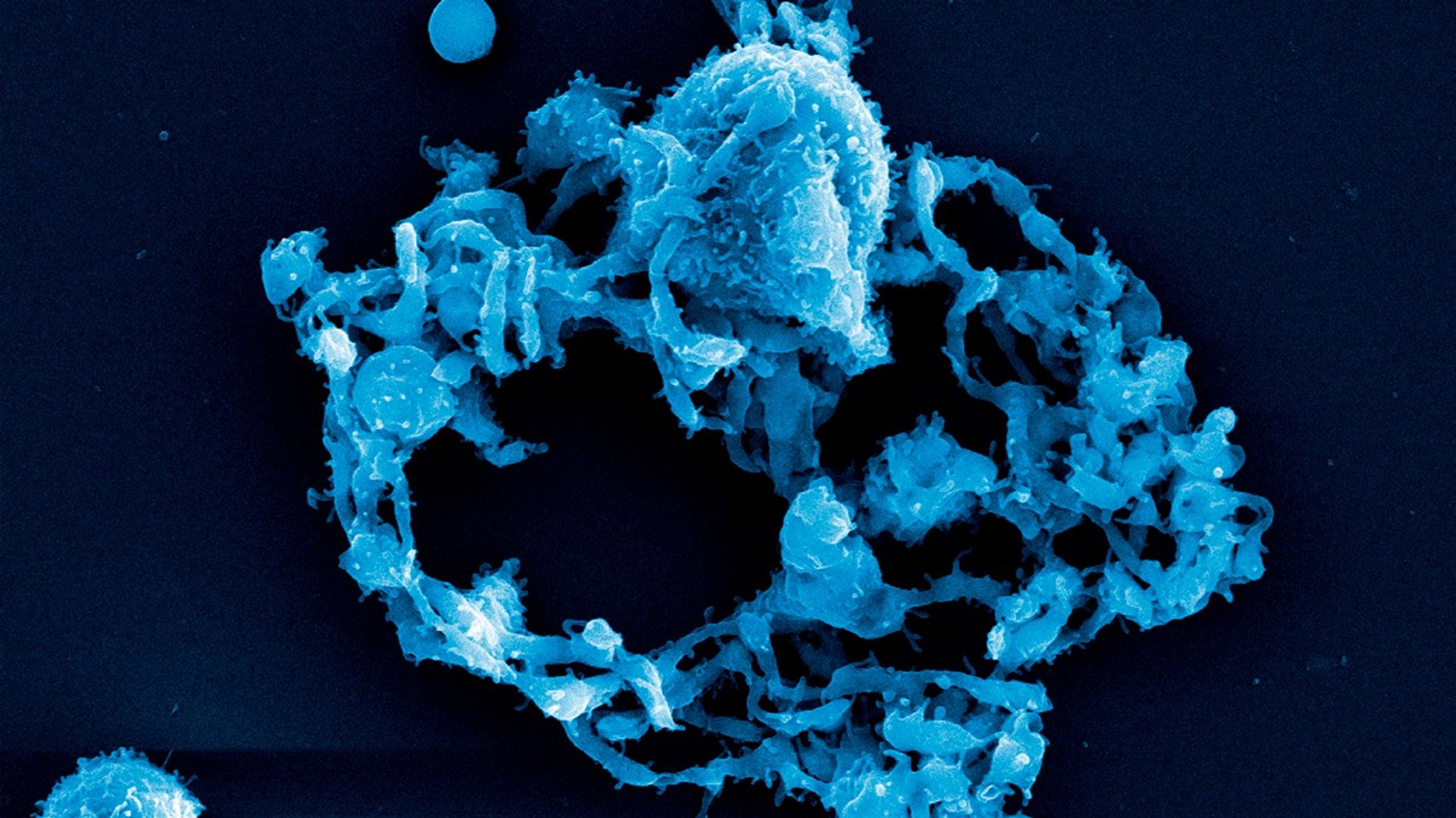 Imagen con color añadido obtenida con un microscopio electrónico de barrido para la investigación MeF1 de la NASA, la cual muestra una célula de megacariocito azul estudiada a bordo de la Estación Espacial Internacional. El cuerpo celular principal se ve en la parte superior central y tiene una intrincada estructura en forma de corona formada por extensiones proplaquetarias alargadas que se irradian hacia afuera en una red compleja. Estas extensiones celulares ramificadas crean una formación circular sobre un fondo negro. Una pequeña plaqueta esférica que se ha desprendido de la célula madre es visible en la esquina superior izquierda. Esta investigación examina cómo las condiciones espaciales afectan la formación de coágulos sanguíneos mediante el estudio de estas células especializadas de la médula ósea, que son responsables de la producción de plaquetas. La arquitectura celular detallada captada en esta imagen ayuda a los científicos a comprender los posibles riesgos para la salud que pueden enfrentar los astronautas durante las misiones espaciales de larga duración, incluyendo las futuras expediciones a la Luna.