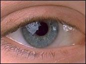 Photo of a blue eye.