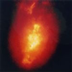 Early Hubble Image of Galaxy NGC 1068