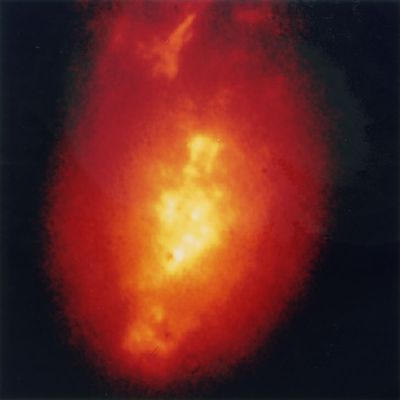 Early Hubble Image of Galaxy NGC 1068