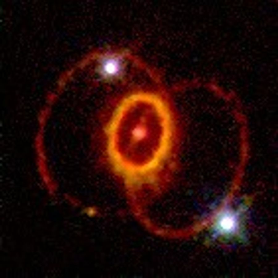 Mysterious Ring Structure around Supernova 1987A