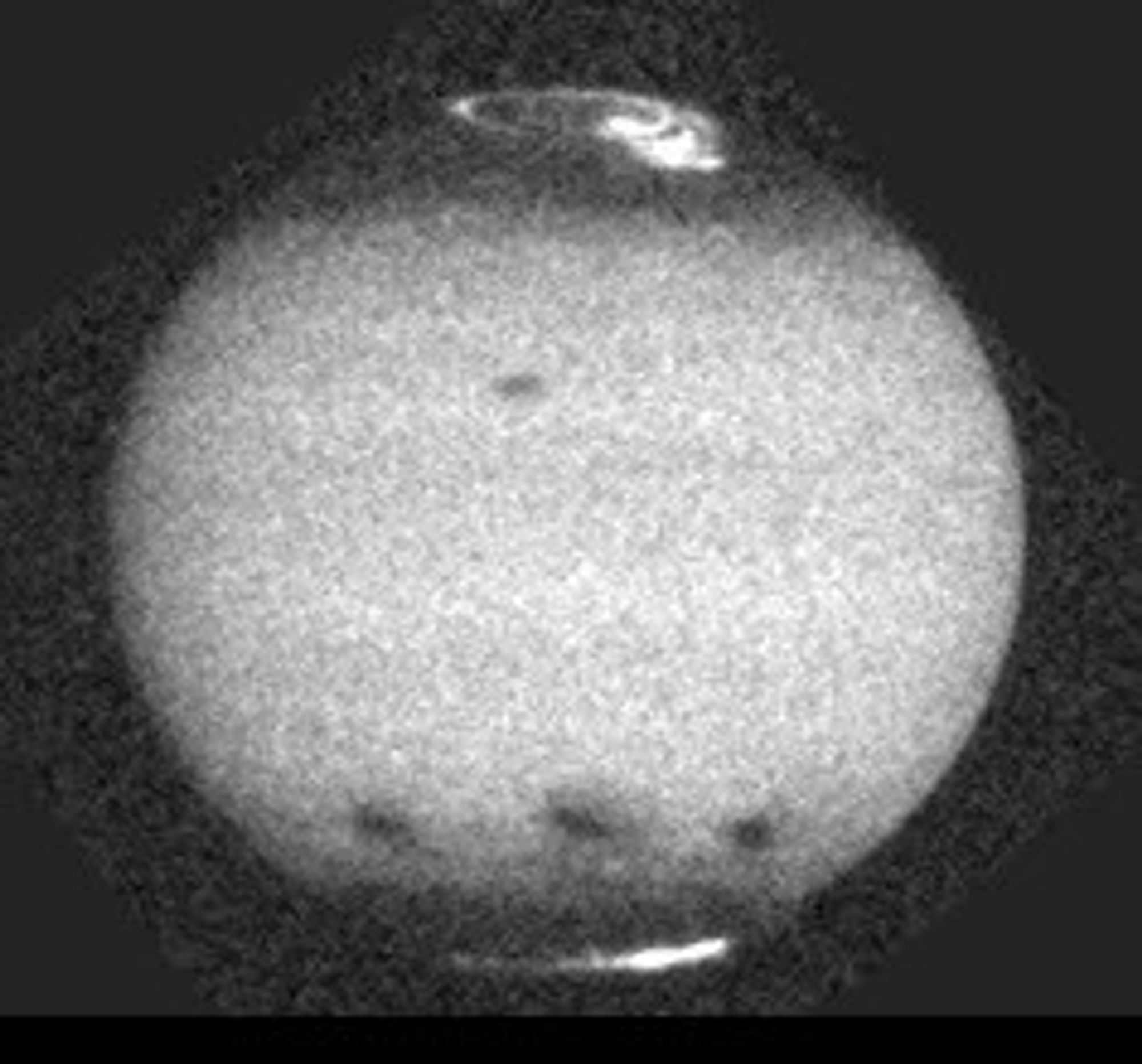 Jupiter Comet Impact