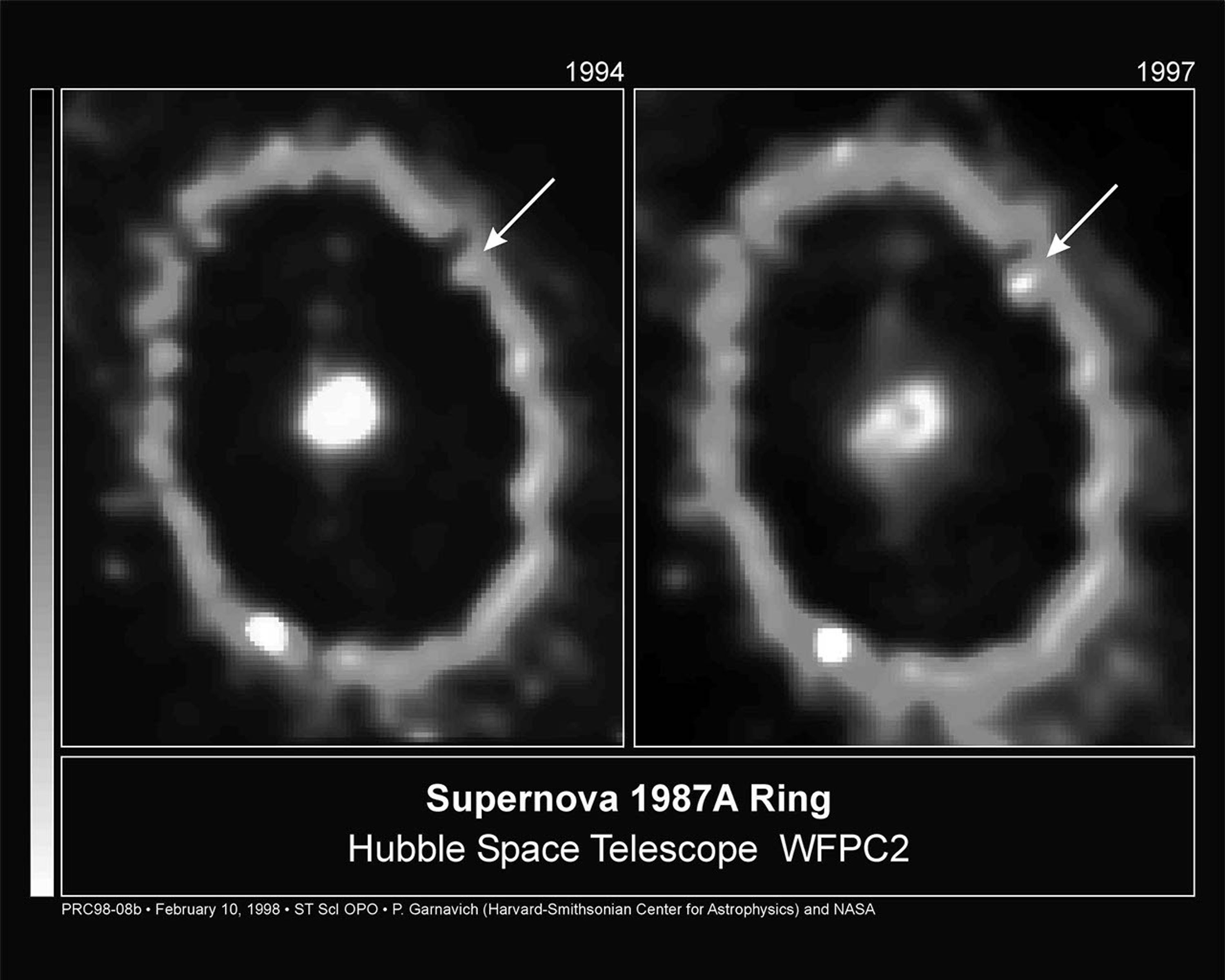 Bright Knot Appears in Supernova 1987a Ring