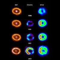 Observations of SN1987A at Different Wavelengths