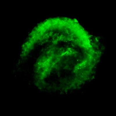 Chandra X-ray Observatory Data of Kepler’s Supernova Remnant