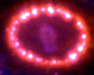 Supernova 1987A: December 15, 2004