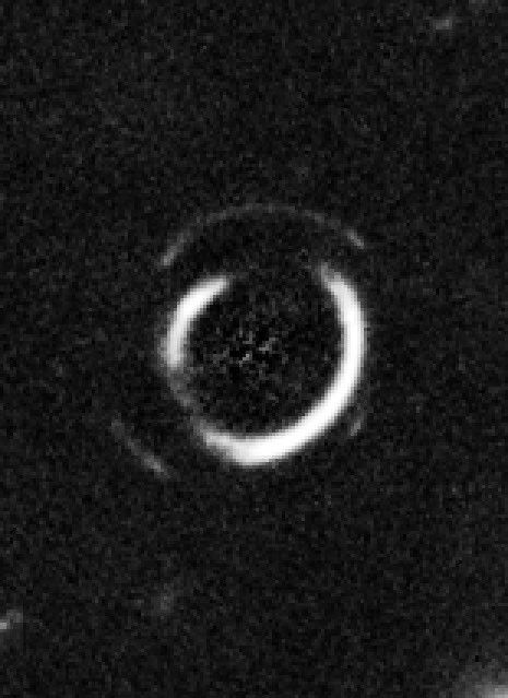 Gravitational Lens System SDSSJ0946+1006 (Zoom onto Double Einstein Ring)