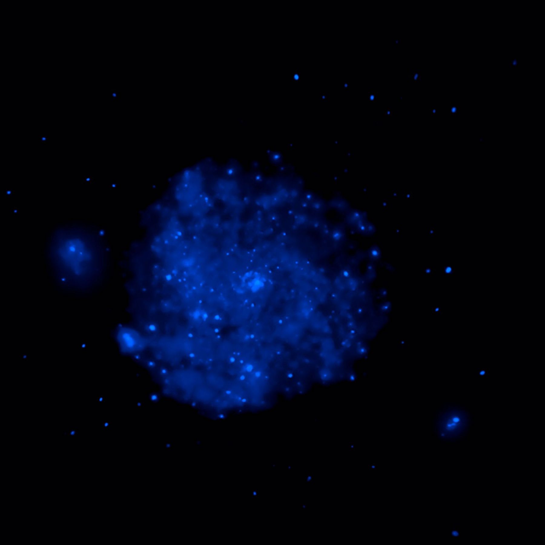 M101 Composite Image: Chandra Data (Blue Component)