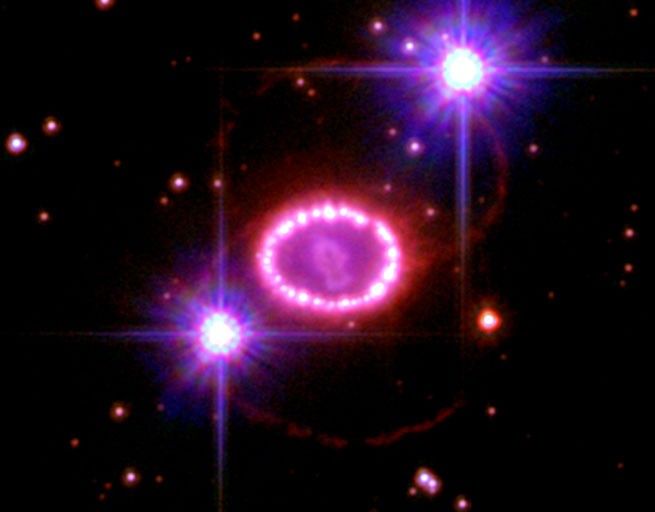 A String of 'Cosmic Pearls' Surrounds an Exploding Star