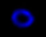 A Chandra View of Supernova 1987A