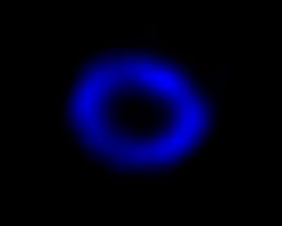 A Chandra View of Supernova 1987A