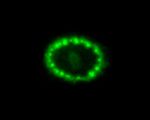 A Hubble View of Supernova 1987A