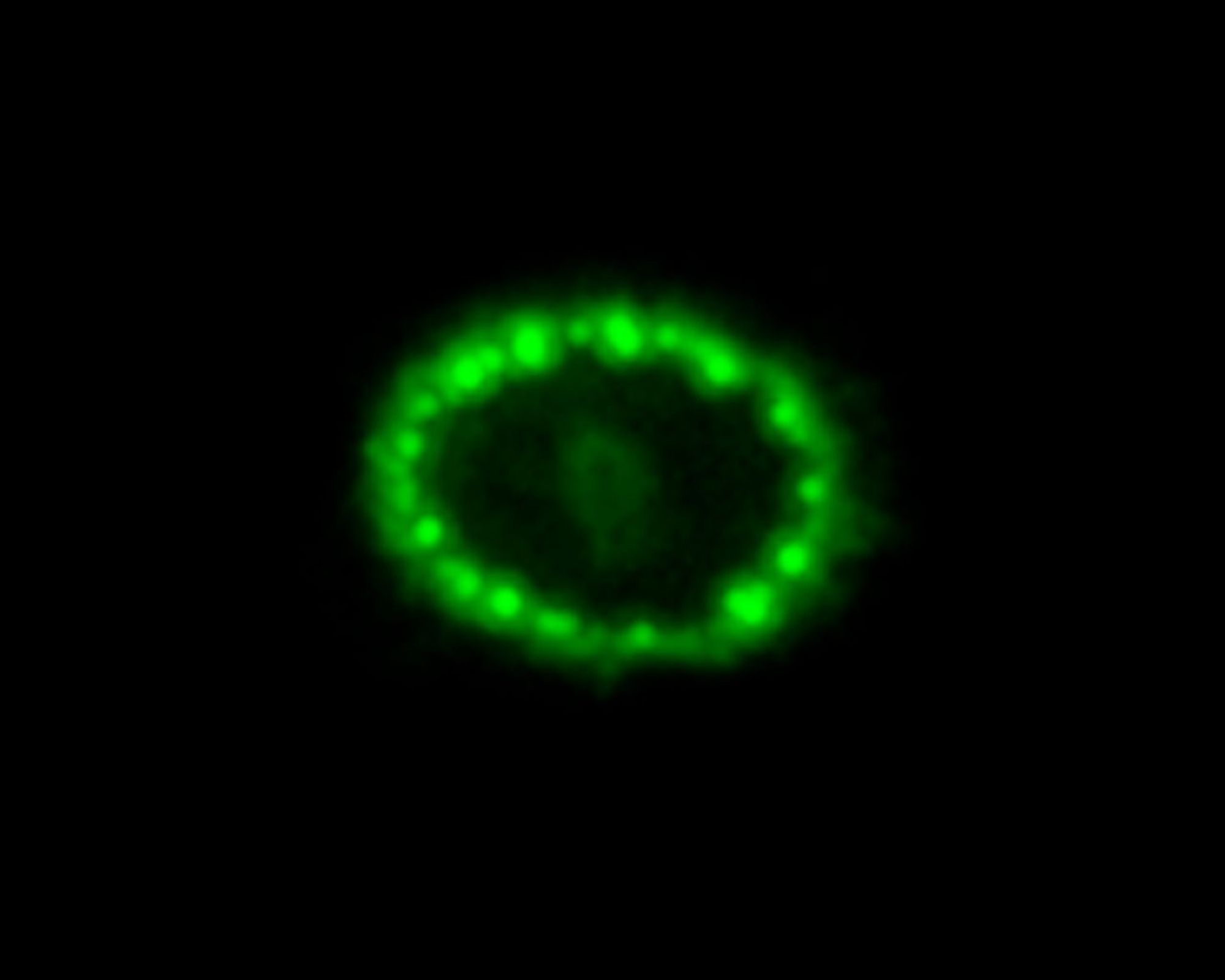 A Hubble View of Supernova 1987A