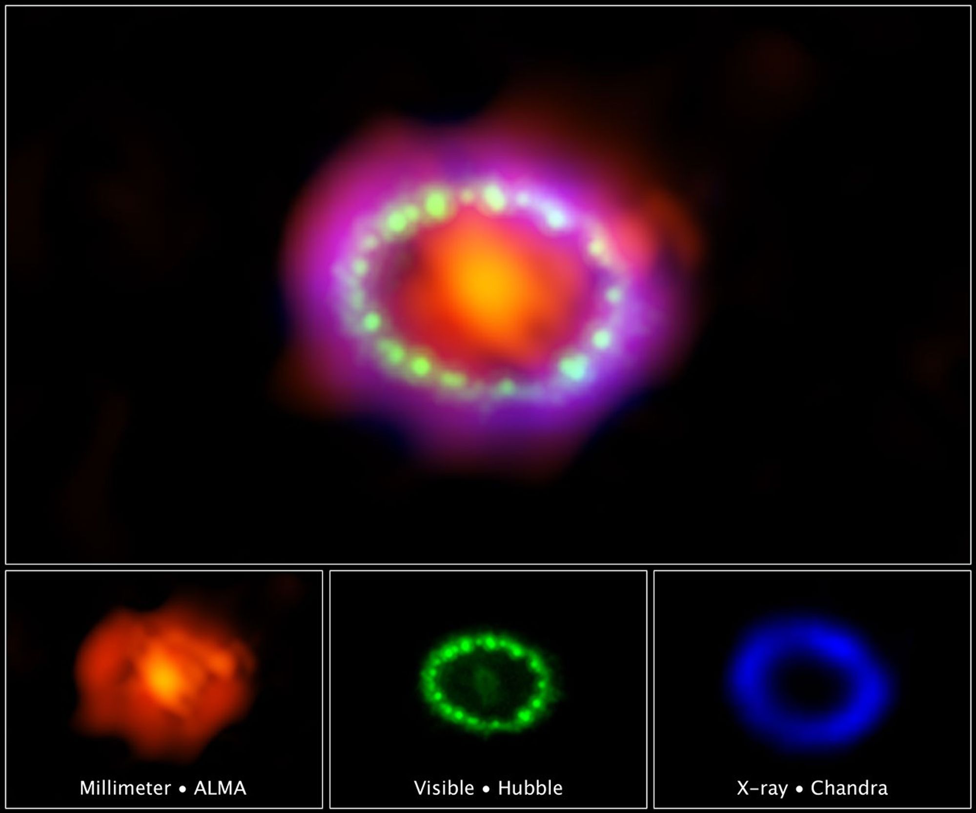 Multiwavelength View of Supernova 1987A