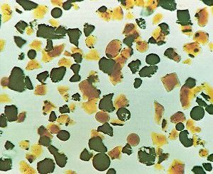 Image of small irregular shapes in green, yellow and dark yellow, scattered,