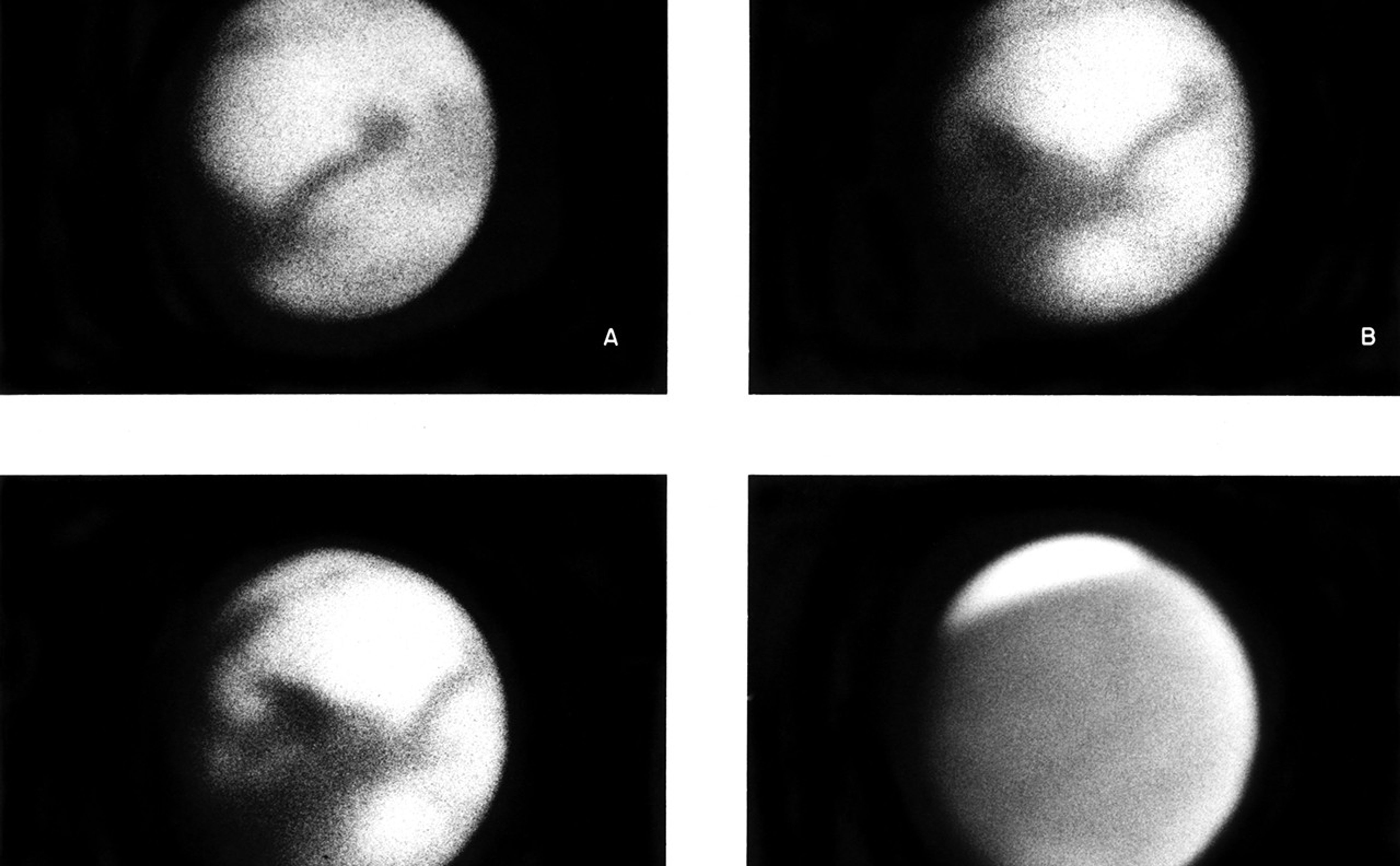 Astronomers took these images of planet Mars through the 100-inch telescope at the Mount Wilson Observatory in California.