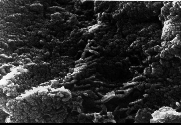 This electron microscope image shows tubular structures of likely Martian origin. These structures are very similar in size and shape to extremely tiny microfossils found in some Earth rocks.