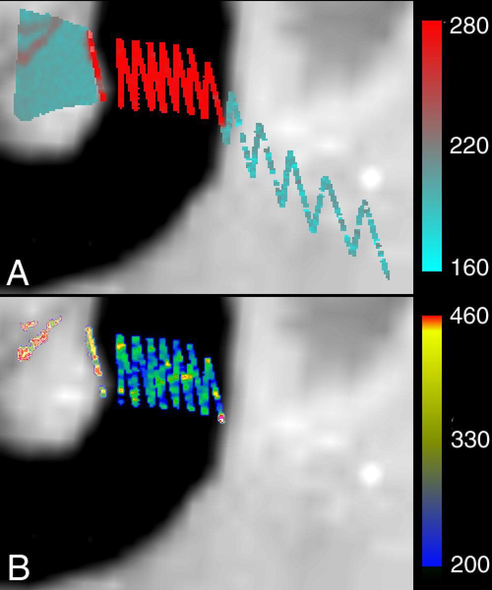 This image of Loki Patera on Jupiter's volcanic moon Io shows data taken by the near-infrared mapping spectrometer onboard NASA's Galileo spacecraft during its Io flyby on Oct. 10, 1999.