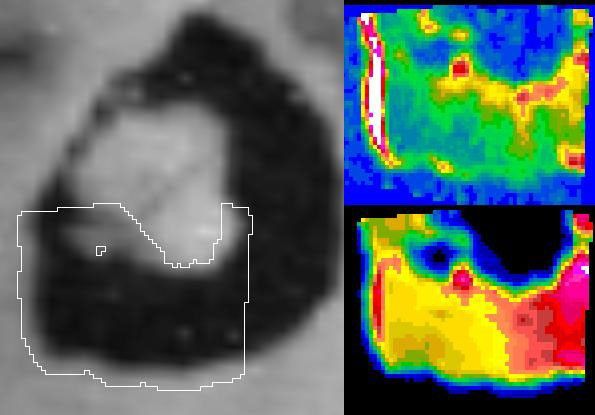 High temperatures observed by NASA's Galileo spacecraft along the western edge of the Loki volcano on Jupiter's moon Io may indicate freshly exposed material at the shore of a lava lake during an Oct. 16, 2001 flyby of Io.