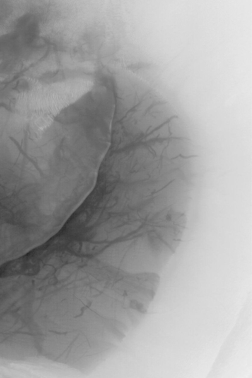 NASA's Mars Global Surveyor shows a dark sand dune on the floor of a crater on Mars. Recent dust devils have disrupted a thin coating of dust on the otherwise dark dune.