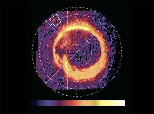 A glowing patch of ultraviolet light on Saturn marks the presence of an electrical circuit that connects Saturn with Enceladus